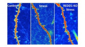 New-Research-Reveals-How-to-Block-Stress-Damage