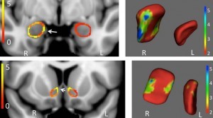 amygdala-nucleus-accumbens