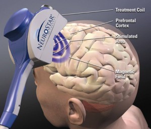 10268612_249979385187605_1454055355444325110_n