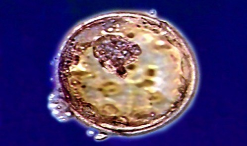 0E1CA9BC00000578-3030433-image-a-1_1428498872010