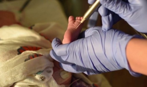 Babies and pain baby demo