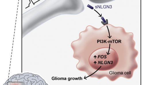 brain-tumor-growth-stimulated-by-nerve-activity-in-the-cortex-stanford-study-finds-neuroinnovations