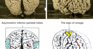 مغز انیشتین