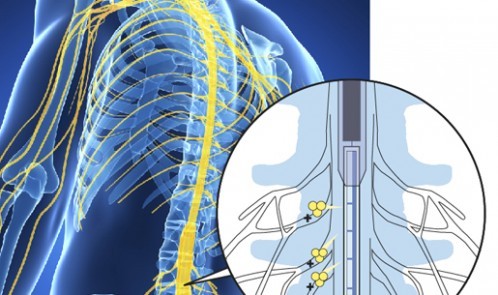 3d rendered illustration of the male nerve system