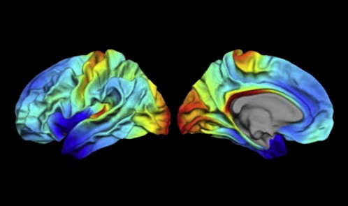 Brain-mapping-image-by-Håkon-Grydeland