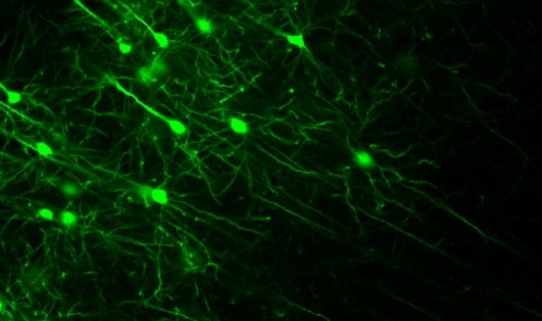 Overactive-neurons-in-the-front-of-the-mouse-brain-shown-in-green
