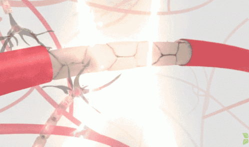 blood-brain-barrier-ultrasound-opening