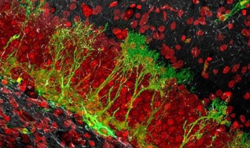 ۳۰E7AE3E00000578-0-Stem_cells_in_the_granular_region_of_the_dentate_gyrus_of_the_hi-a-26_1454677412837