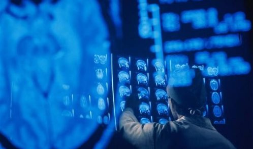 MRI_scan_2938831b-large_trans++pJliwavx4coWFCaEkEsb3kvxIt-lGGWCWqwLa_RXJU8