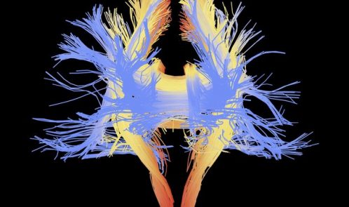 White matter fibres of the human brain