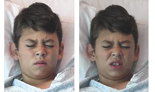 pediatric_pain_recognition(