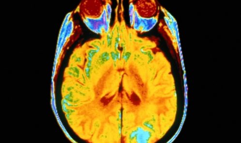 ab245935-687c-45cc-876f9038d86b3612