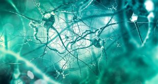 شروع آلزایمر