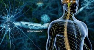 تحول در درمان ام اس