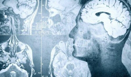 احتمال بازگشت به زندگی تا پنج دقیقه پس از مرگ