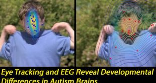 هر نقطه بیانگر موضعی خیره کننده برای هر کودک مشغول تماشای فیلم است. نقاط آبی در بالا بیانگر کودکان نوپایی است که بطور معمول در حال رشد هستند. نقاط قرمز بیانگر کودکان نوپای مبتلا به اختلالات طیف اوتیسم (ASD) است. در طی آزمایش، چهره دچار محو شدگی نشده است. اعتبار: دانشگاه ژنو