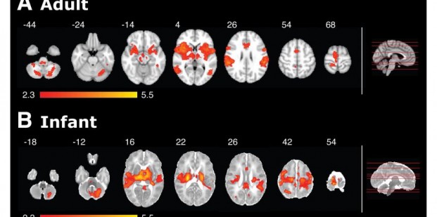 Babies and pain comparison figure