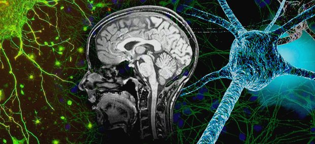 neurocollage2