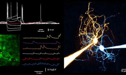 TIC-Electrophysiology