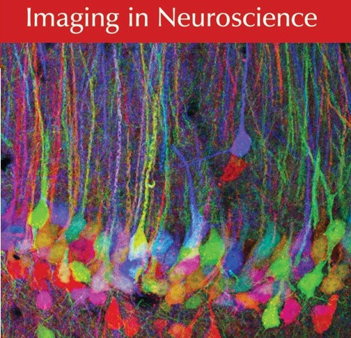 imaging