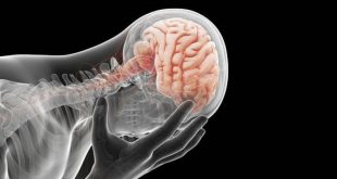 مبتلایان به افسردگی