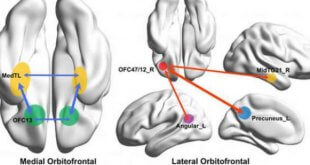 منشا فیزیکی افسردگی