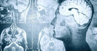 احتمال بازگشت به زندگی تا پنج دقیقه پس از مرگ